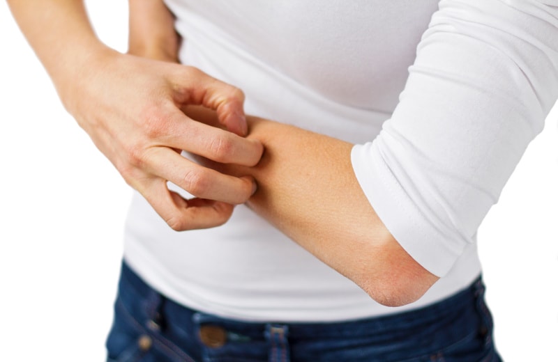 8 Causes of Psoriasis