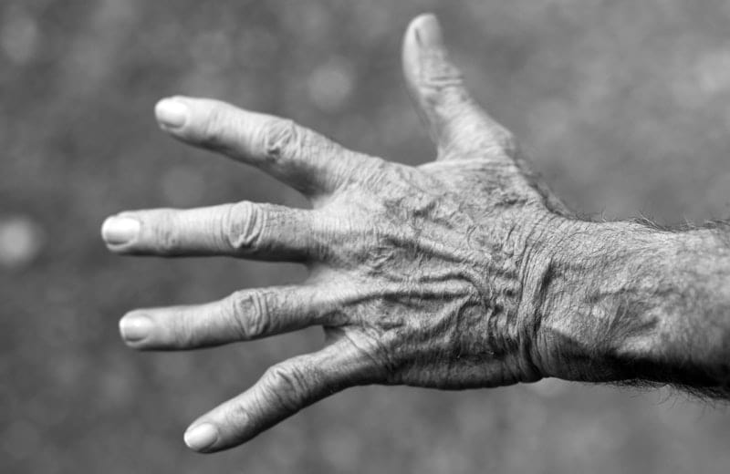 9 treatments of arthritis